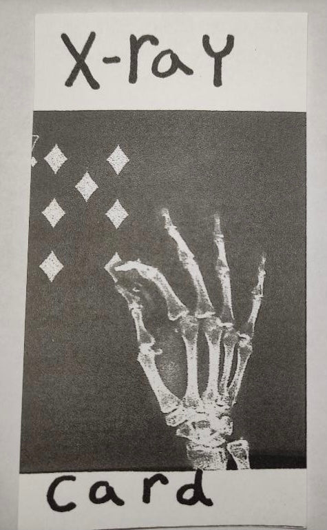 X-ray Card by Bennie Chickering